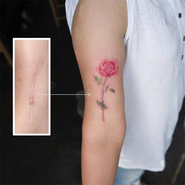 Scar Cover Up Tattoos That Will Amaze You