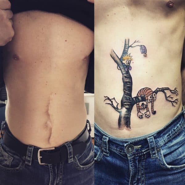 Scar Cover Up Tattoos That Will Amaze You