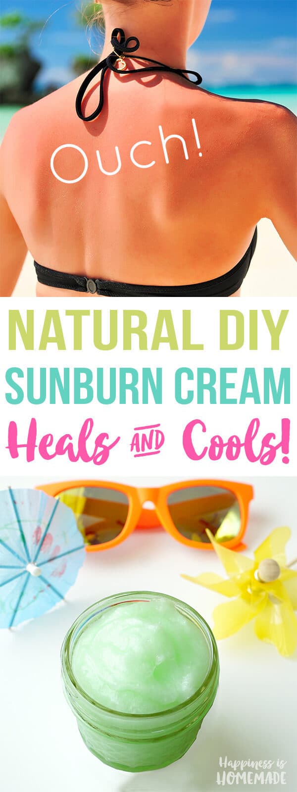 Excellent Homemade Sunburn Relief Remedies