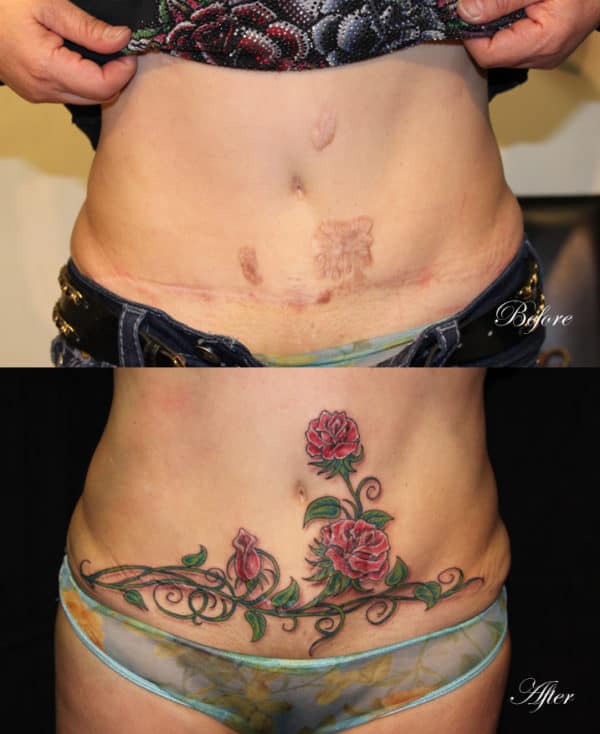 Scar Cover Up Tattoos That Will Amaze You