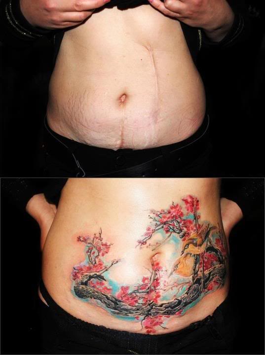 Scar Cover Up Tattoos That Will Amaze You