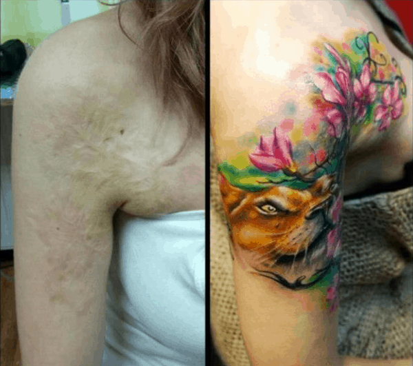 Scar Cover Up Tattoos That Will Amaze You