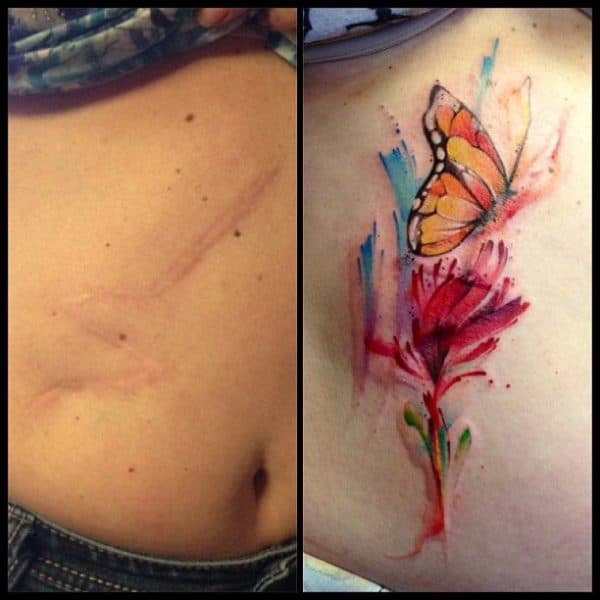 Scar Cover Up Tattoos That Will Amaze You