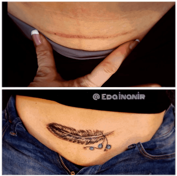 Scar Cover Up Tattoos That Will Amaze You