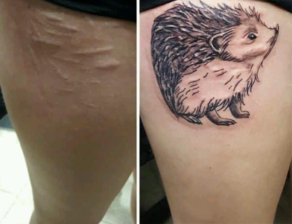 Scar Cover Up Tattoos That Will Amaze You