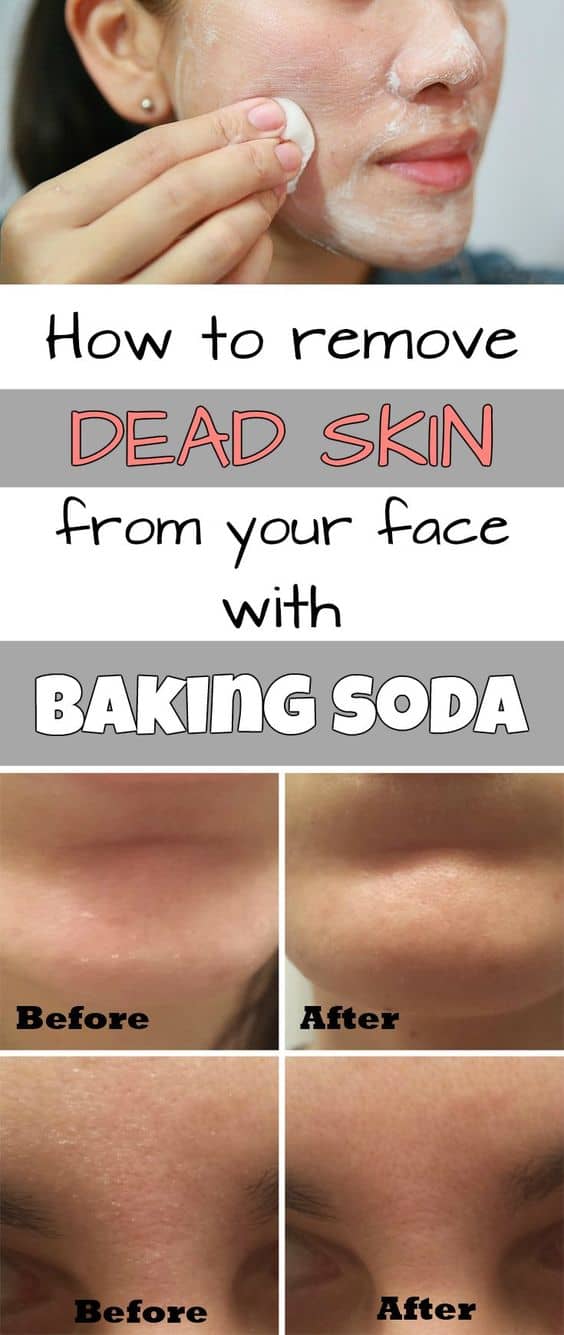 How To Naturally Solve Beauty Problems Using Homemade Recipes With Baking Soda