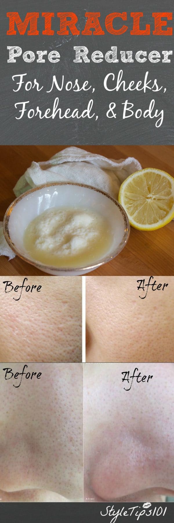 How To Naturally Solve Beauty Problems Using Homemade Recipes With Baking Soda