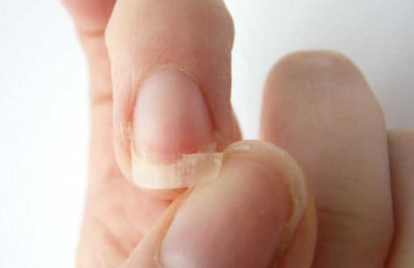 Five Completely Natural Remedies To Strengthen Your Nails Immediately