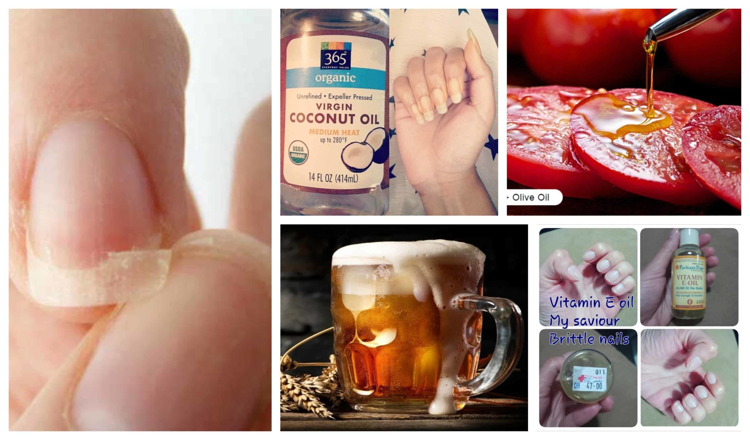 Five Completely Natural Remedies To Strengthen Your Nails Immediately