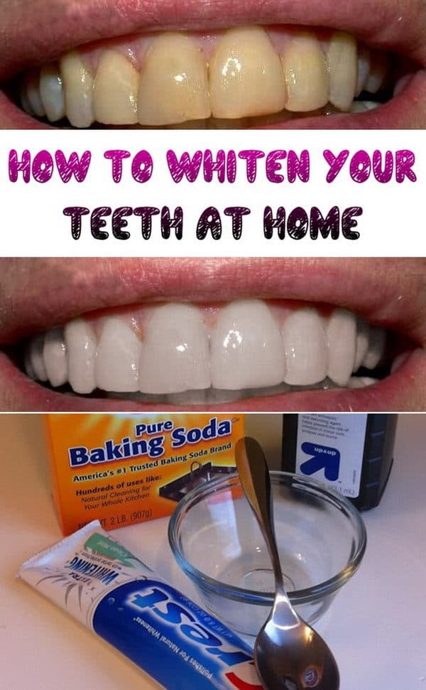 The Best Homemade Remedies To Whiten Your Teeth Naturally