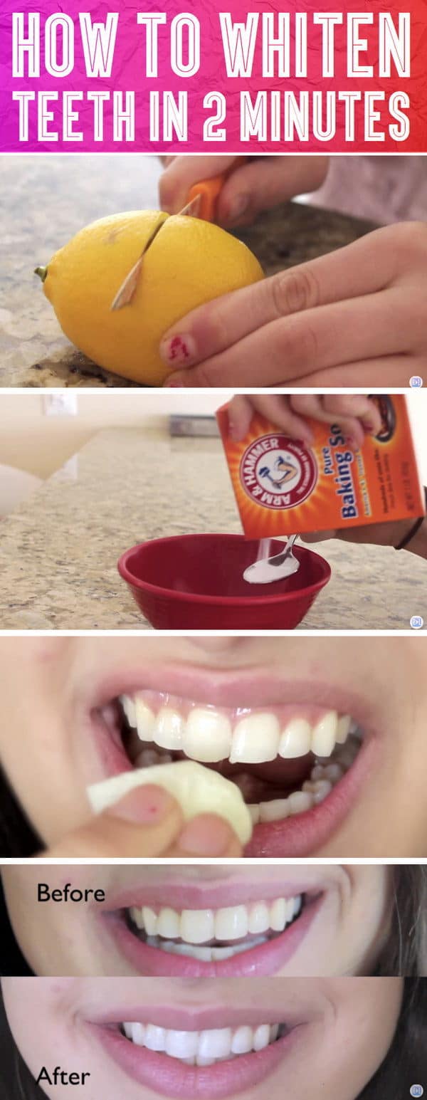 The Best Homemade Remedies To Whiten Your Teeth Naturally