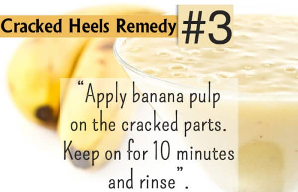 Homemade Recipes To Get Rid Of Cracked Leg Feet