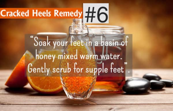 Homemade Recipes To Get Rid Of Cracked Leg Feet