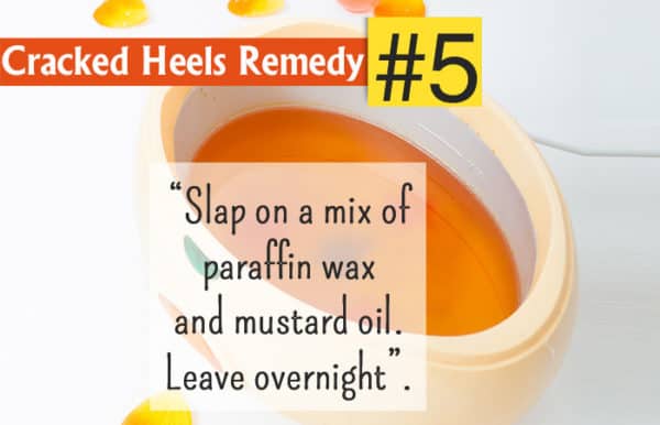 Homemade Recipes To Get Rid Of Cracked Leg Feet