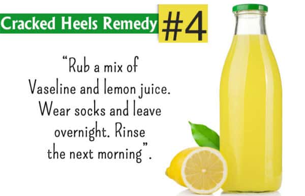 Homemade Recipes To Get Rid Of Cracked Leg Feet