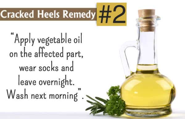 Homemade Recipes To Get Rid Of Cracked Leg Feet