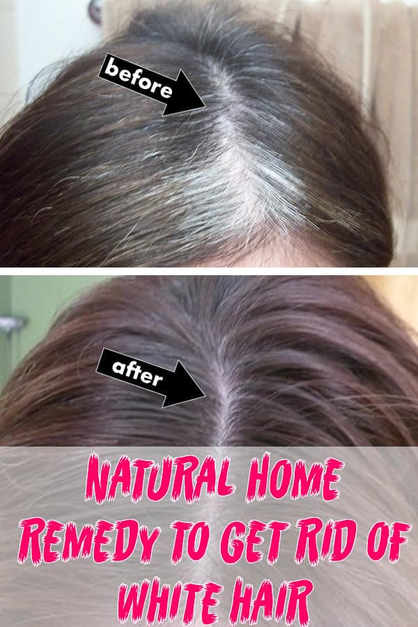 Natural Homemade Remedies To Get Rid Of White Hair All For Fashion Design 