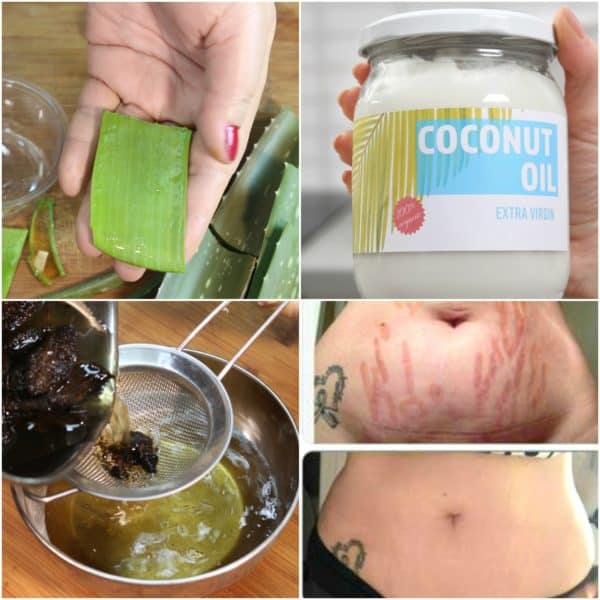 Natural Homemade Mask To Get Rid Of The Stretch This Summer