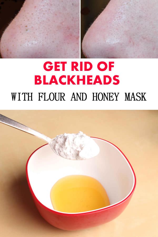The Most Effective Homemade Remedies To Get Rid Of Blackheads