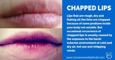 Wonderful Chapped Lips Homemade Remedies That Are Great For The Cold ...