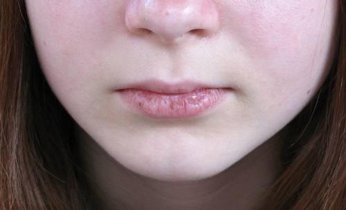 Wonderful Chapped Lips Homemade Remedies That Are Great For The Cold Weather