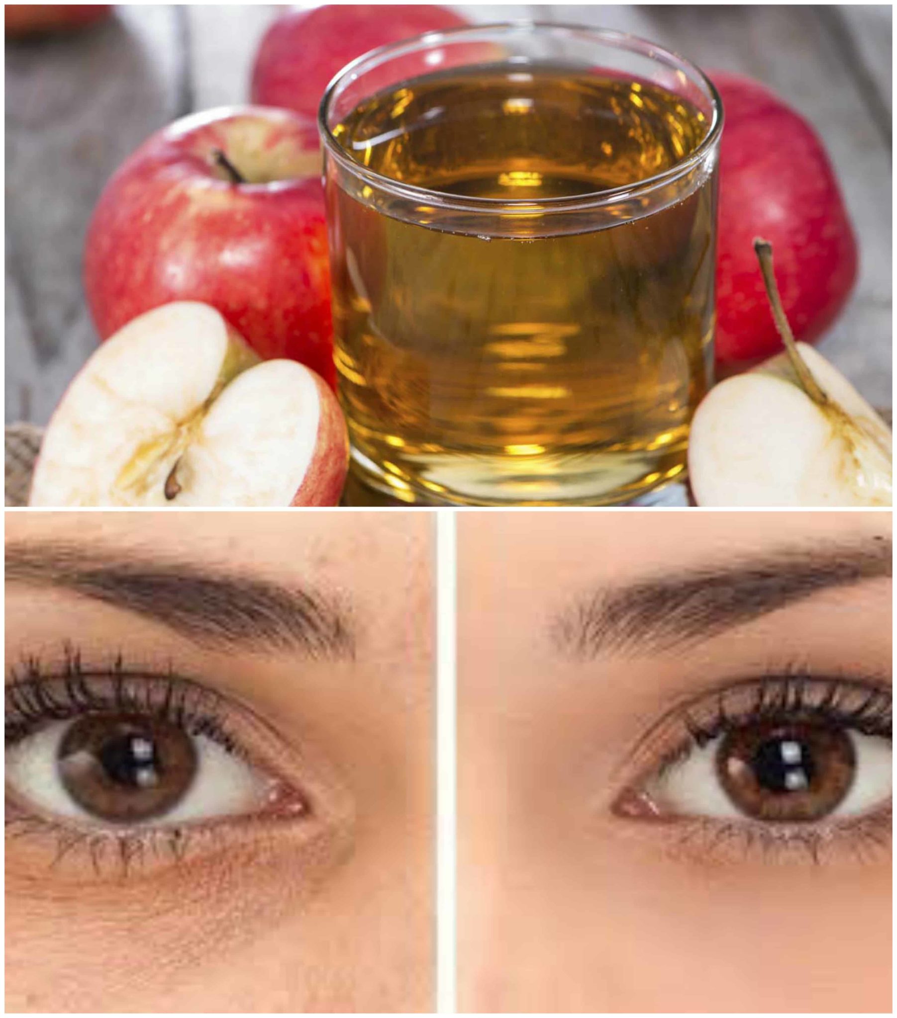 Effective Homemade Remedies For Dark Circles Under Your Eyes ALL FOR