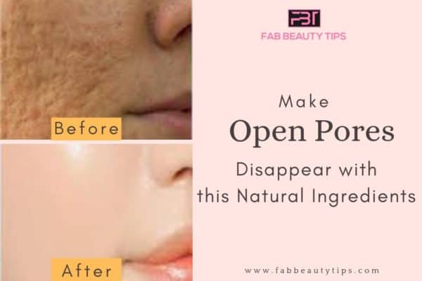 Natural Homemade Open Pores Remedies That Are Very Effective