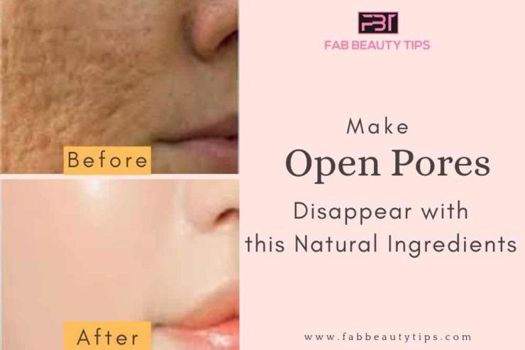 Natural Homemade Open Pores Remedies That Are Very Effective - ALL FOR ...