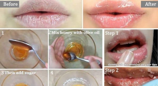 Wonderful Chapped Lips Homemade Remedies That Are Great For The Cold Weather