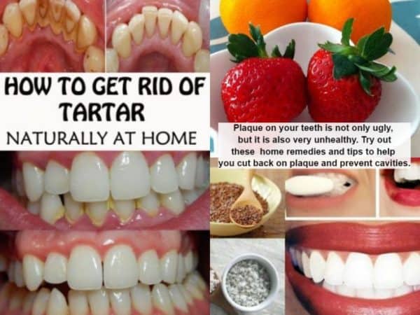 Dental Plaque Homemade Remedies That Will Whiten Your Teeth