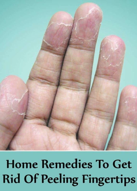 Natural Remedies For Peeling Hands That Are Really Effective ALL FOR