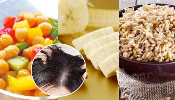 How To Get Rid Of Dandruff With These Natural Remedies