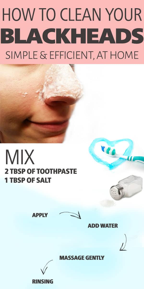 The Best Blackheads Remedies That You Can Make At Home In Just A Few Steps