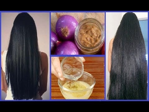 Amazing Natural Remedies That Will Help You Make Your Hair Grow Faster ...