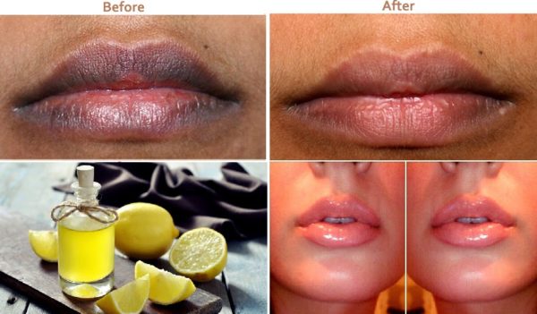 Helpful Homemade Citrus Fruits Remedies That Will Amaze You