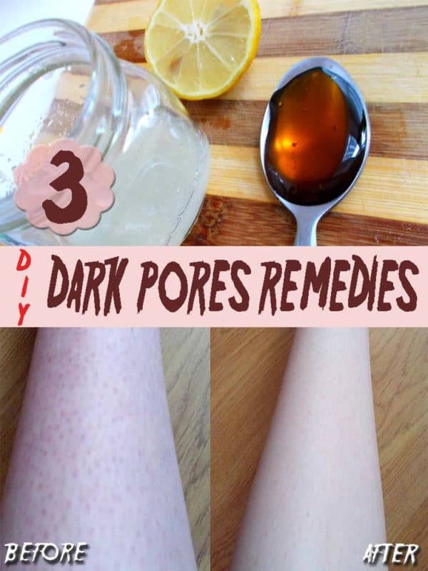 Helpful Homemade Citrus Fruits Remedies That Will Amaze You