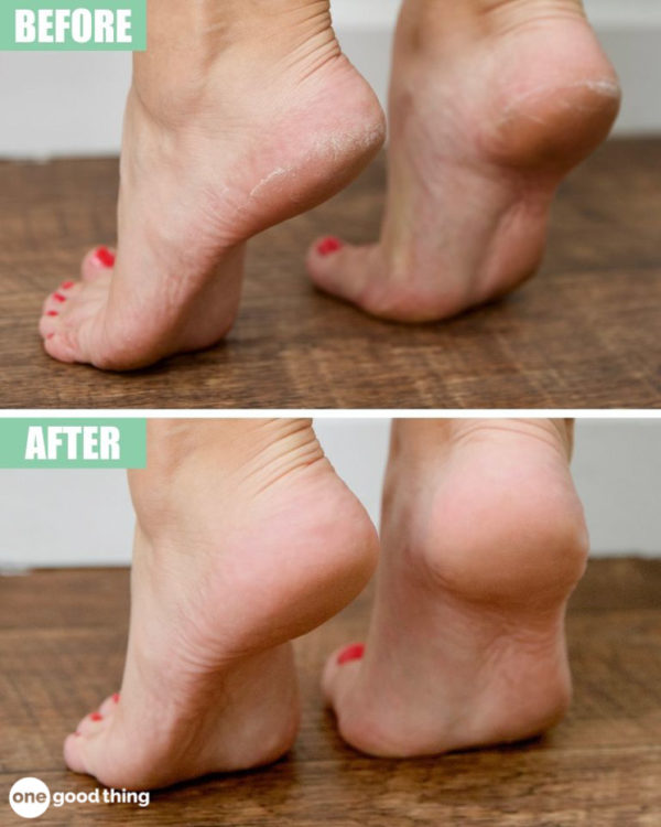 The Best Homemade Foot Treatments That Will Make Your Heels Soft