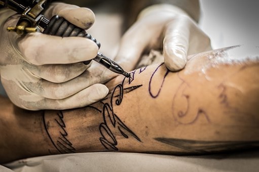 What You Need to Know About Tattoo Removal