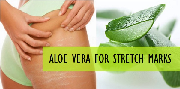 Homemade Aloe Vera Remedies That You Are Going to Love