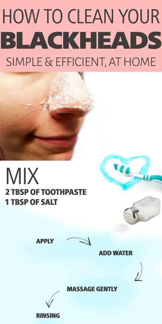 Effective Remedies That Will Help You Get Rid Of Blackheads Naturally