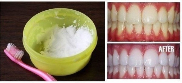 Revolutionary Teeth Whitening Remedies That Are Amazing For Your Yellow Teeth