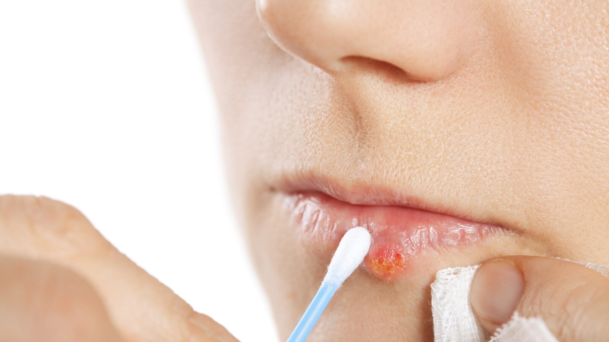 Helping Tips For The Best Lips Care During The Cold Winter - ALL FOR ...